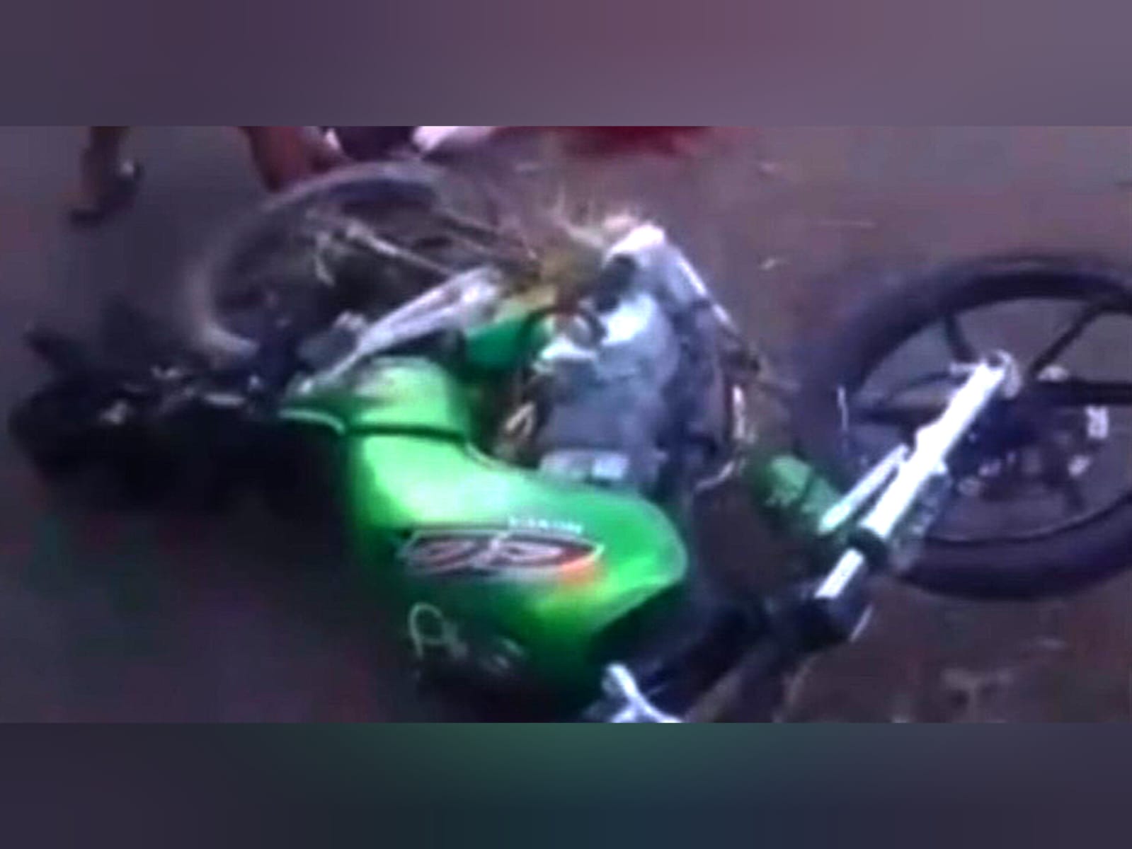 Jovem tem perna amputada em grave acidente de moto