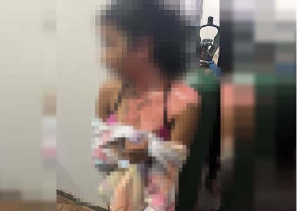 Polícia busca por tia que queimou sobrinha de 14 anos por ciúmes do marido