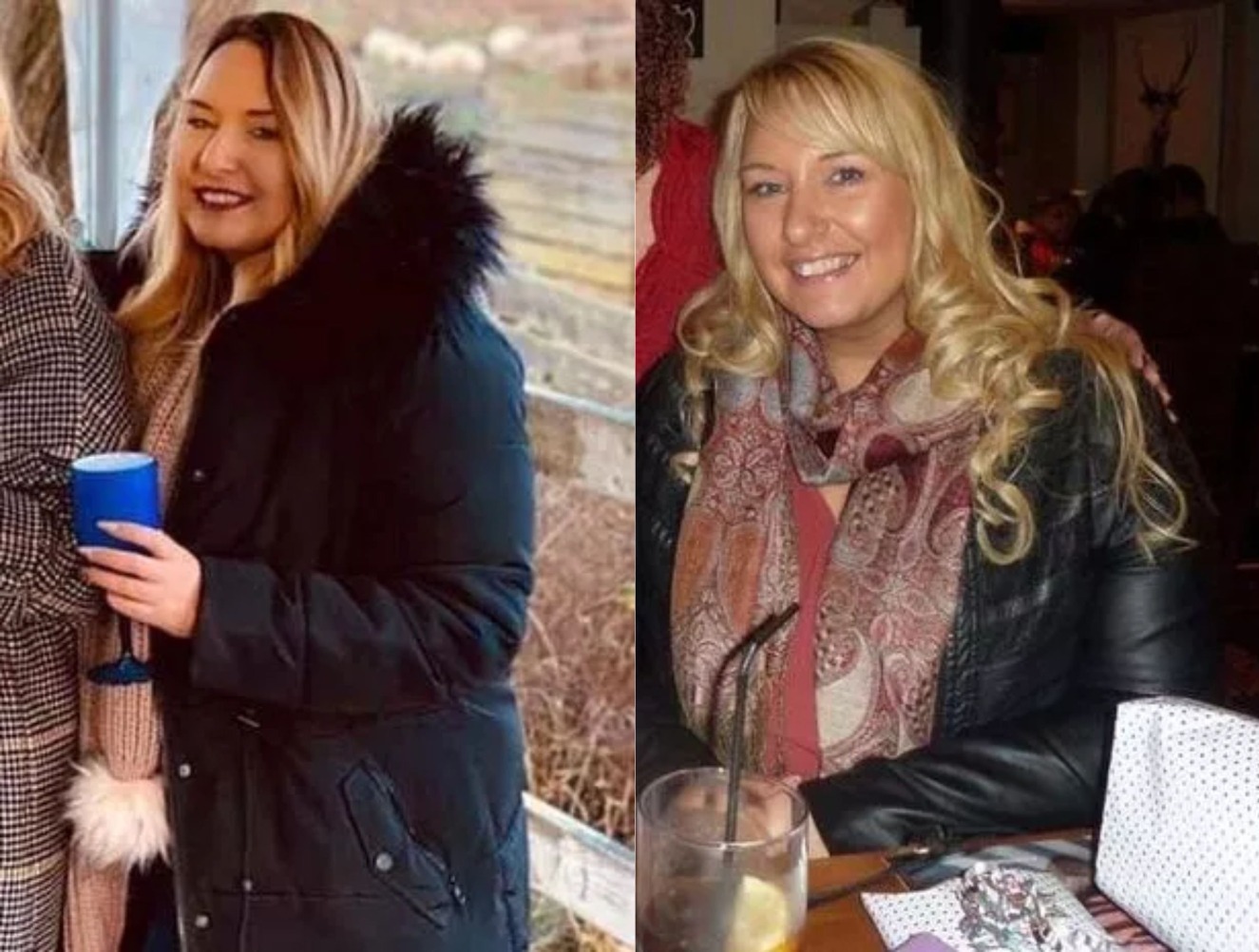 Revoltada, mulher pega gargalo de garrafa e retalha rosto de homem que errou idade dela em bar