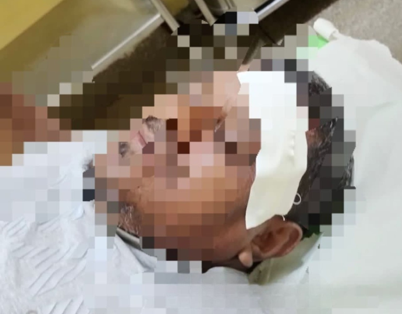 Vereador sofre acidente com motocicleta em Maués