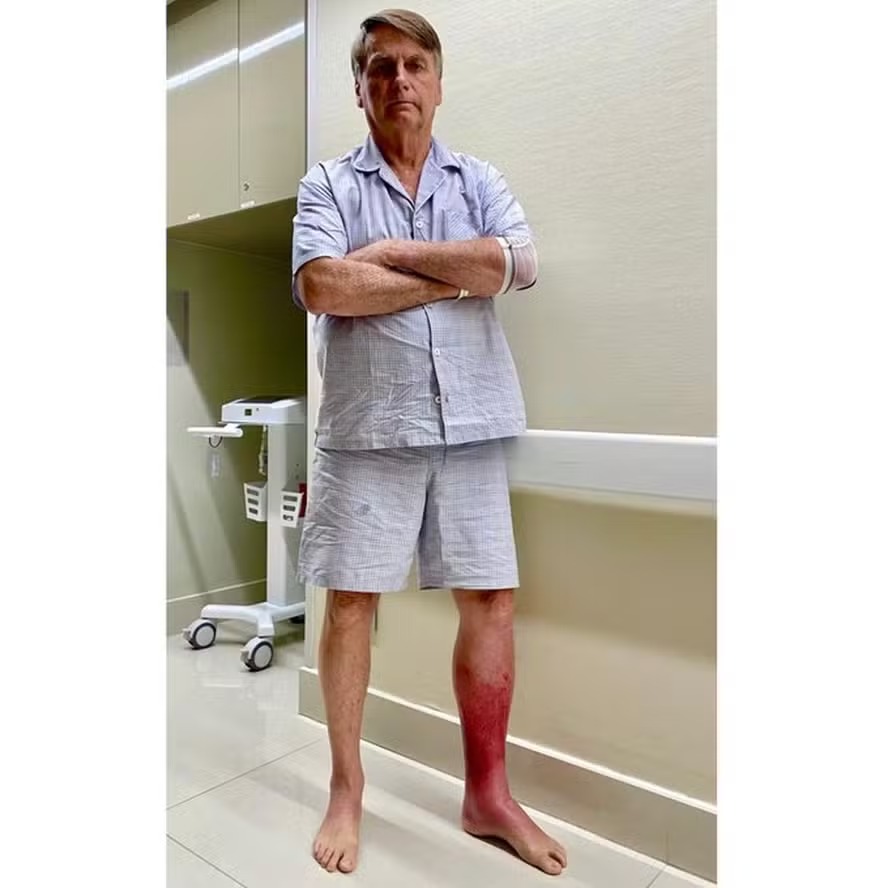Bolsonaro mostra ferimentos e segue internado sem previsão de alta