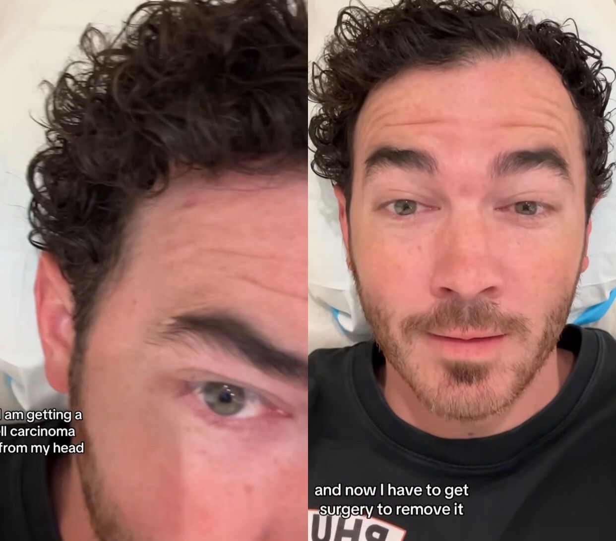 Kevin Jonas, do Jonas Brothers, passa por cirurgia para remover câncer