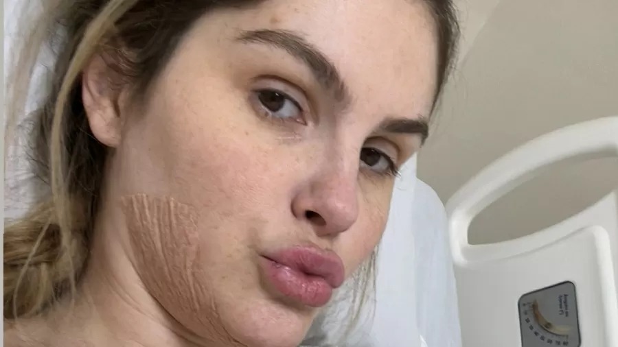 Bárbara Evans faz cirurgias plásticas 6 meses depois de dar à luz gêmeos