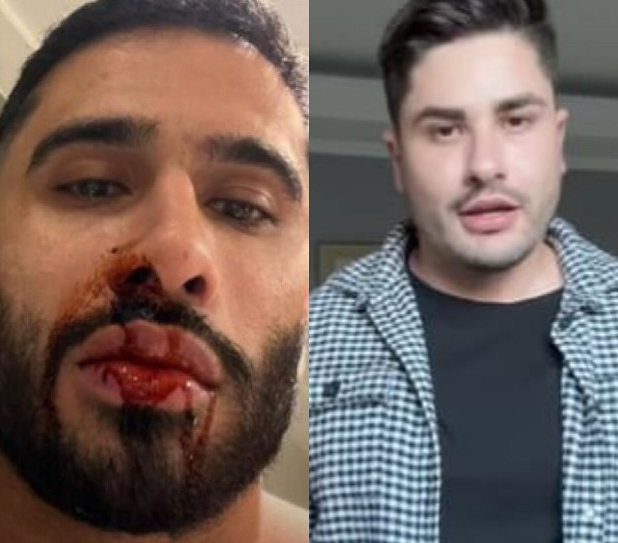 Ex acusa Lucas Souza de agressão e mostra rosto ensanguentado 