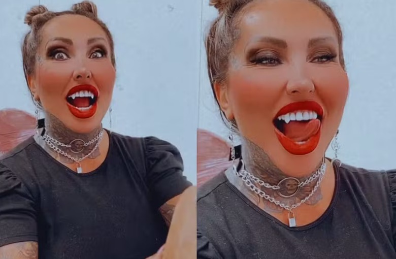 Após 6 litros de silicone, Sabrina Boing Boing troca dentes por presas