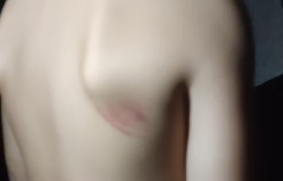 Professora de creche prende mãos e cola boca de menina de 4 anos com fita