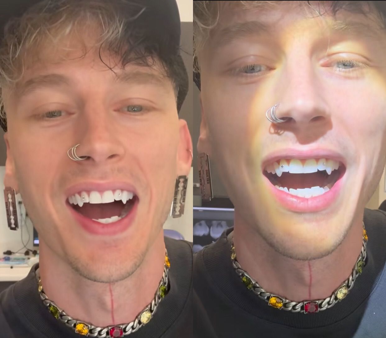 Bizarro: Ex de Megan Fox implanta presas de vampiro nos dentes