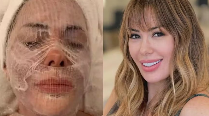 Influencer relata tratamento facial à base de cocô de pássaro 