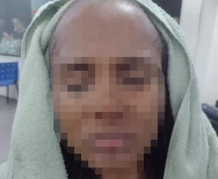 Homem agride a esposa a marteladas e a obriga a raspar o próprio cabelo