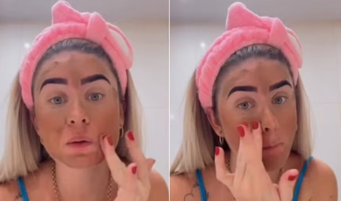 Influencer viraliza ao usar fezes em skincare: 'deu certo pra mim'
