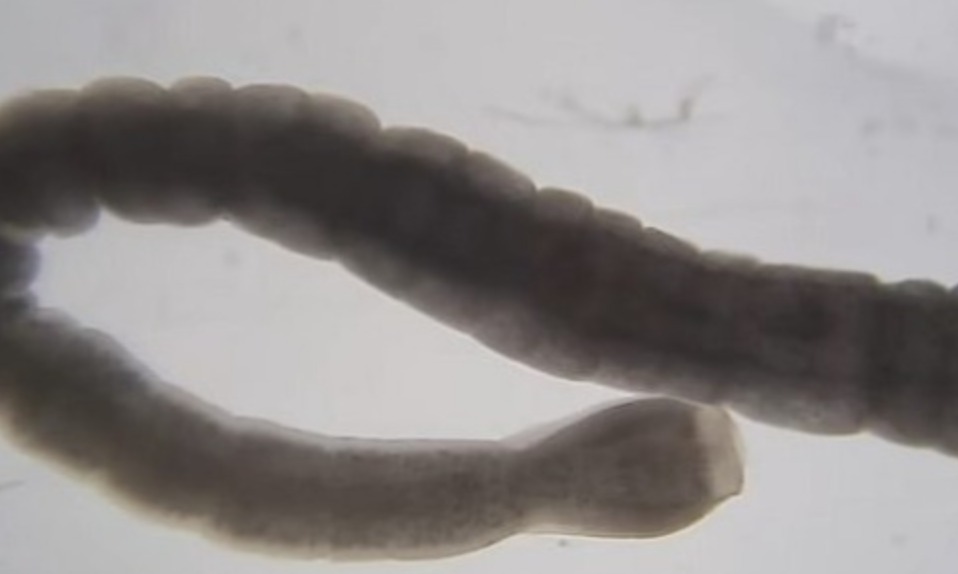 Mulheres comem ovos de tênia para emagrecer e médicos fazem alerta 