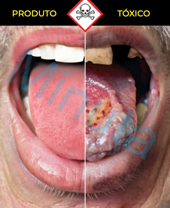 Anvisa apresenta novas imagens contra fumo em embalagens de cigarros