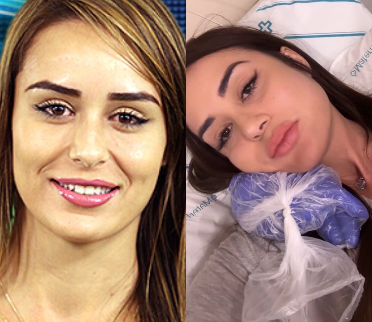 Ex-BBB Letícia Santiago é internada com infecção nos ossos 