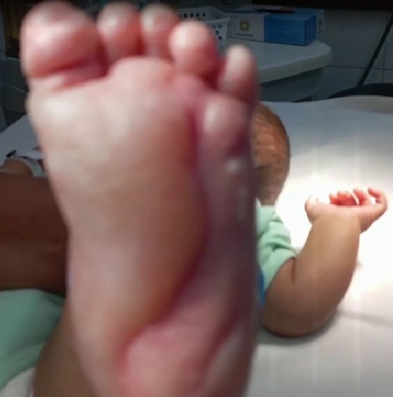 Mãe é presa suspeita de queimar o filho de 6 meses com água quente 