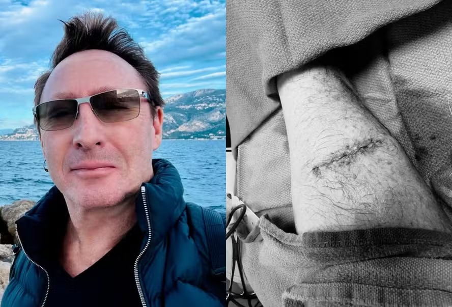 Filho de John Lennon é diagnosticado com câncer 