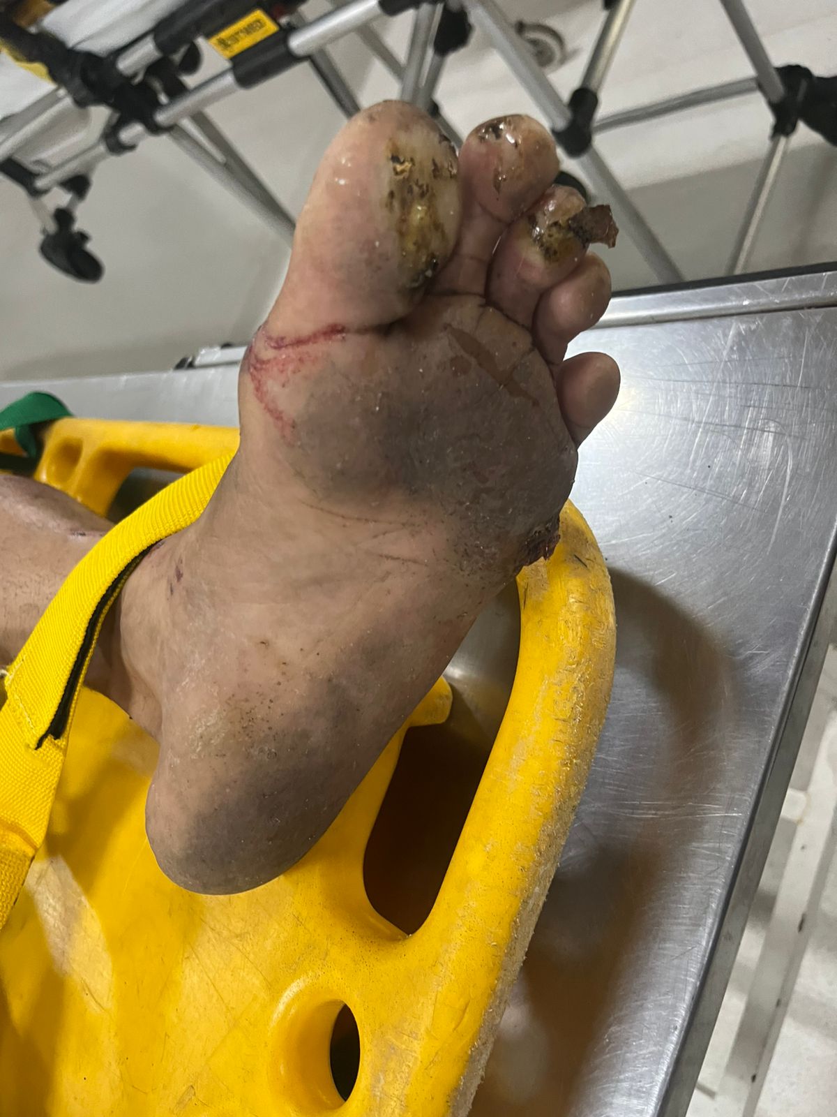 Homem recebe choque elétrico e despenca de árvore na Praça 14 