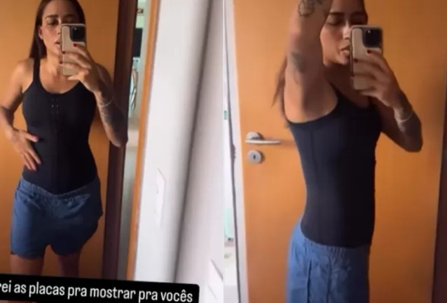 MC Loma exibe sua silhueta um mês após cirurgia de lipo HD