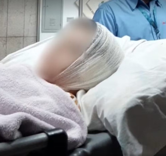 Criança tem parte da orelha arrancada em ataque de pitbull