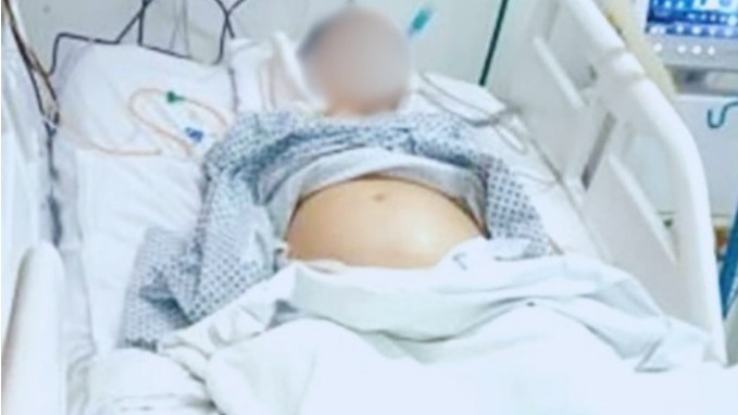Morre bebê de jovem mantida viva por aparelhos durante a gestação