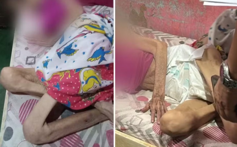 Filho é preso por deixar a mãe de 73 anos sem comer por vários dias