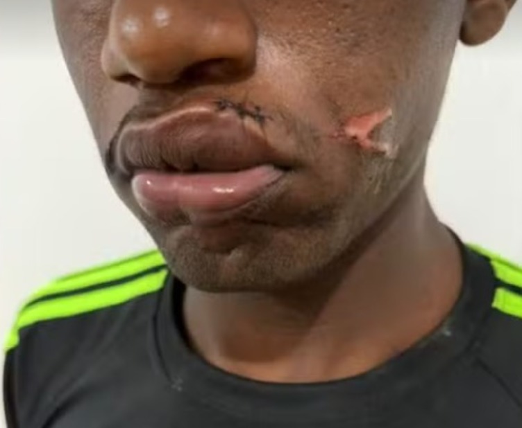 Mulher agride companheiro com pá após ele chegar tarde em casa