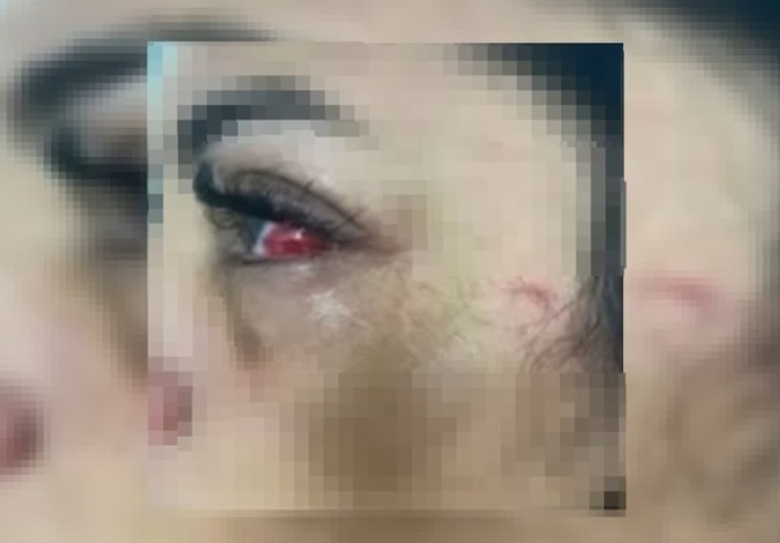 Homem agride companheira por beber sem ele na companhia de amigos