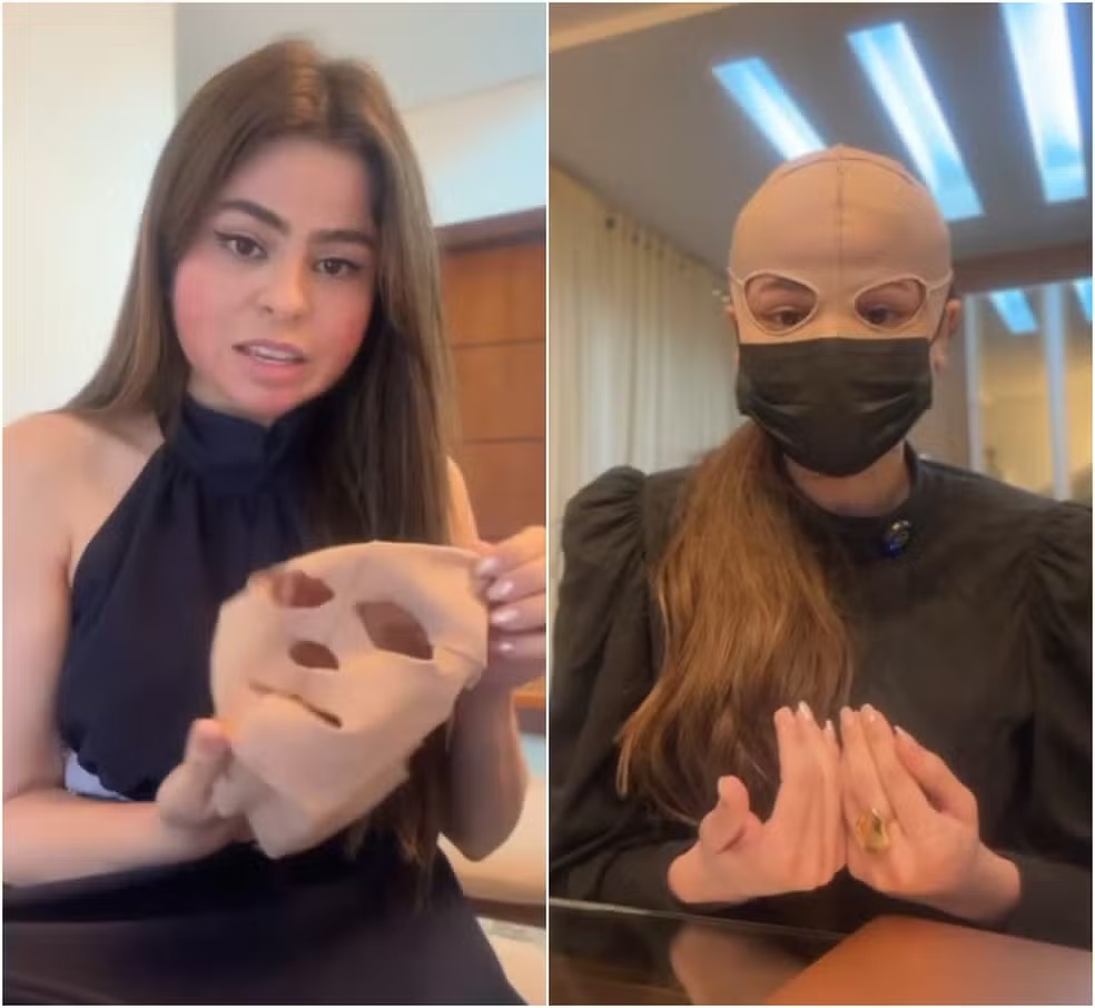 Médica sofre queimaduras no rosto após peeling e precisa usar máscara