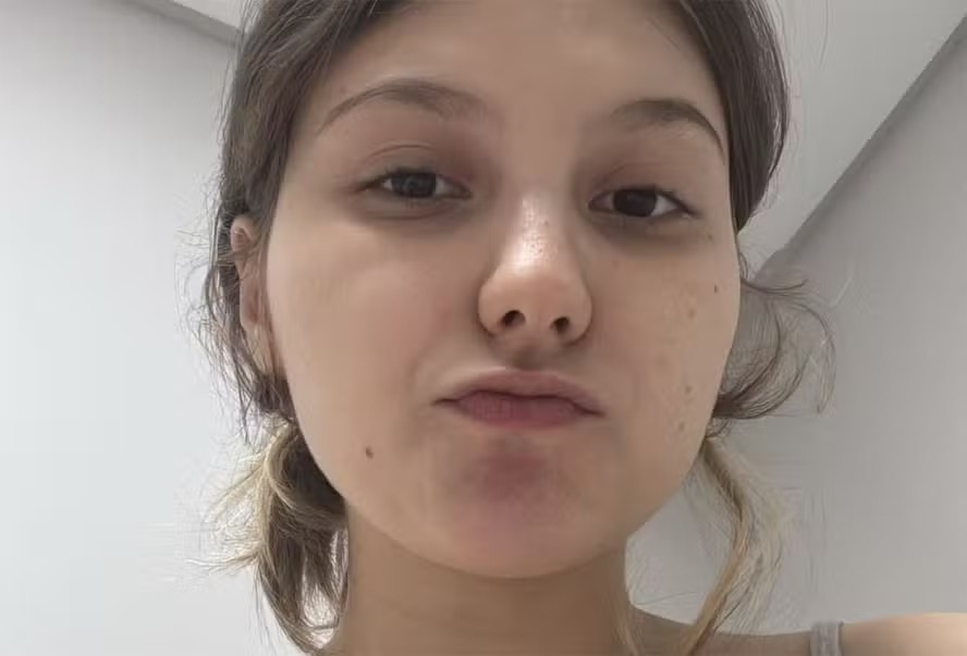 Com fortes dores, Isabel Veloso passará por cirurgia