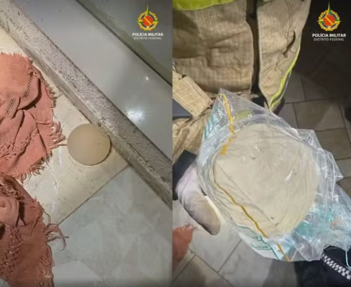 Mulher é espancada e tem prótese de silicone arrancada pelo companheiro