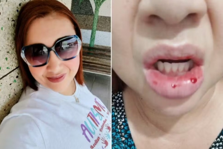 Colgate pode ser processada por reação alérgica em boca de cliente