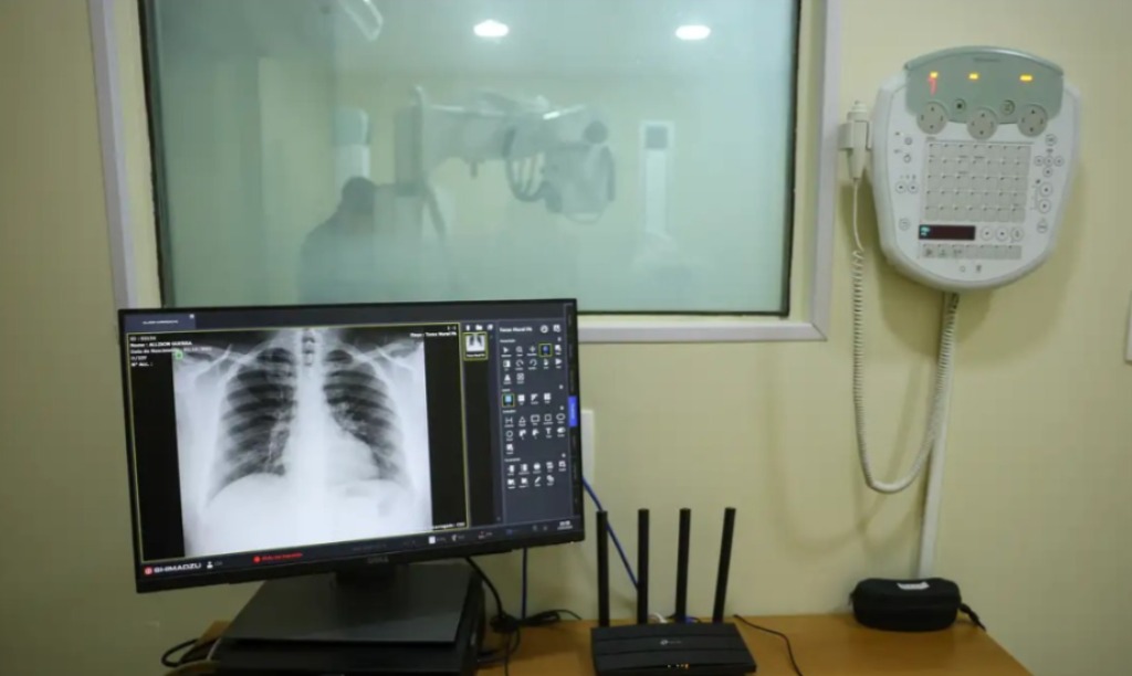 Brasil tem aumento de hospitalizações por Influenza A, alerta Fiocruz