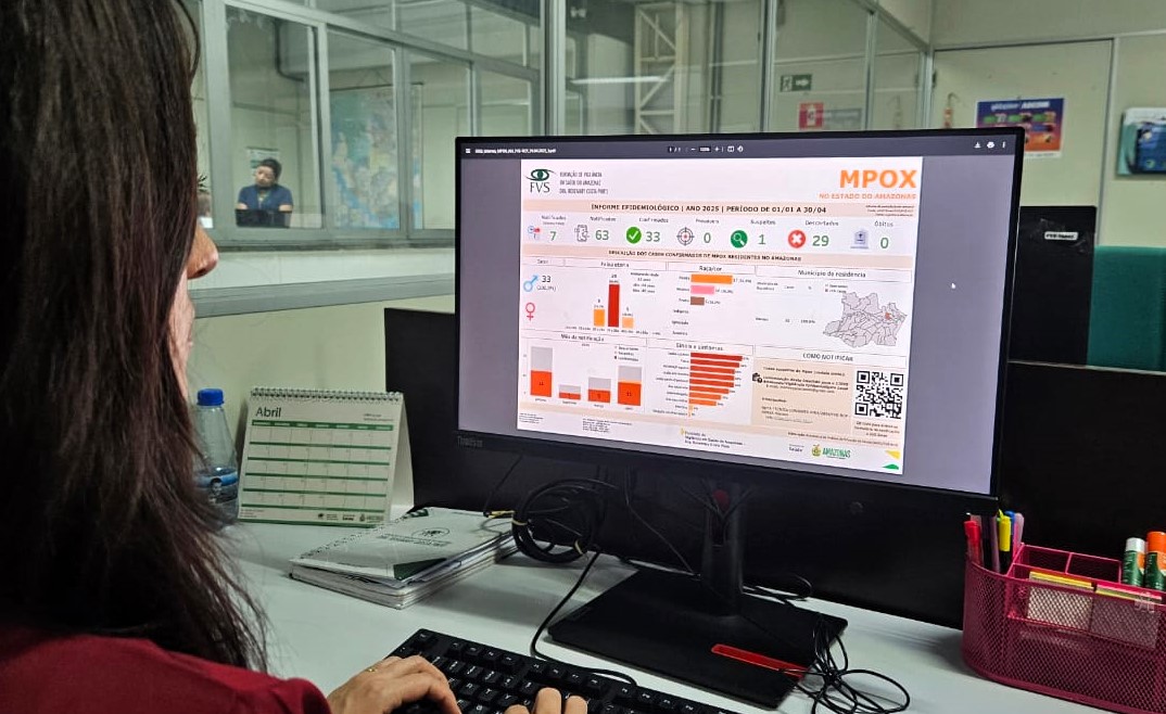Amazonas tem 3 novos casos confirmados de Mpox e notificações sobem para 63