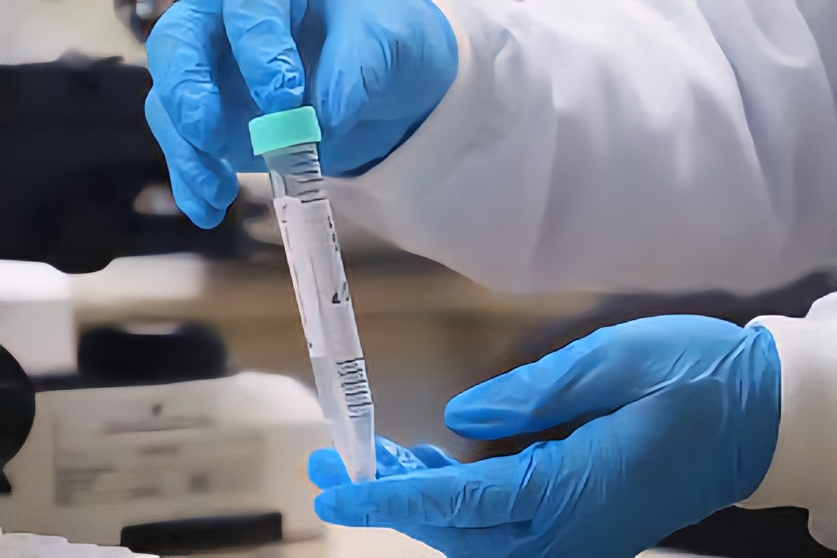 Amazonas registra redução nos casos de Mpox 