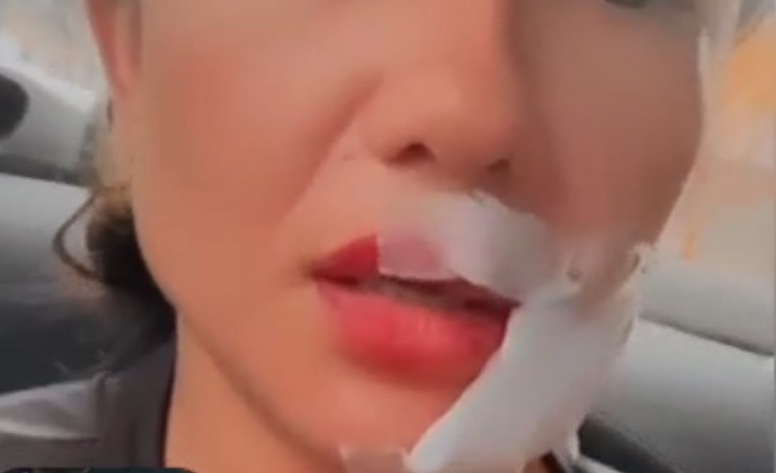 Ex ataca e esfaqueia rosto de industriária ao descer da rota em Manaus