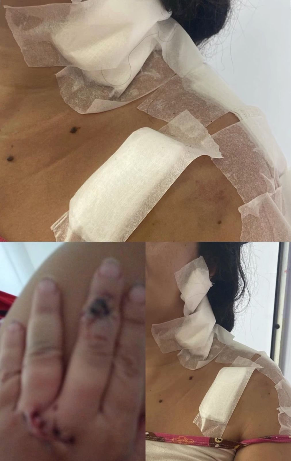 Mãe e filha de 10 meses são atacadas com gargalo de garrafa no bairro São Jorge