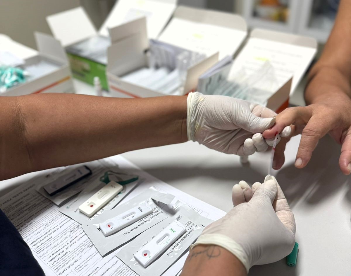 Casos de hepatites virais caem 34% no Amazonas no primeiro semestre de 2025