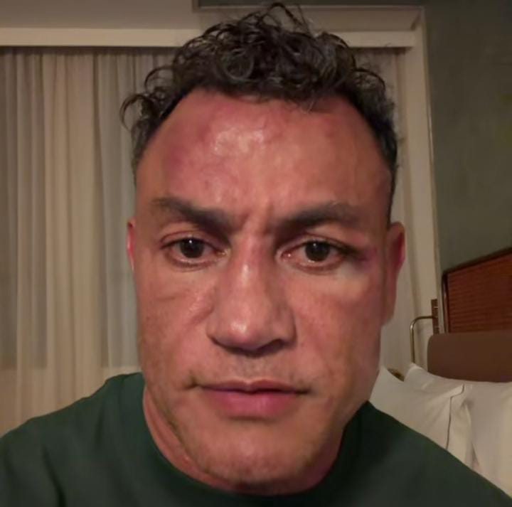 Popó anuncia aposentadoria do boxe após confusão em luta