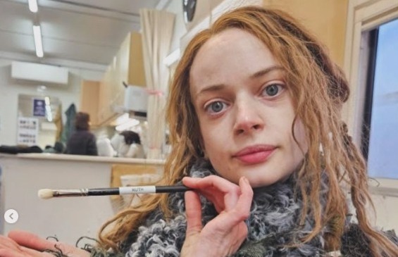 Aos 29, atriz de 'Como Treinar o Seu Dragão" revela que amputou 2ª perna