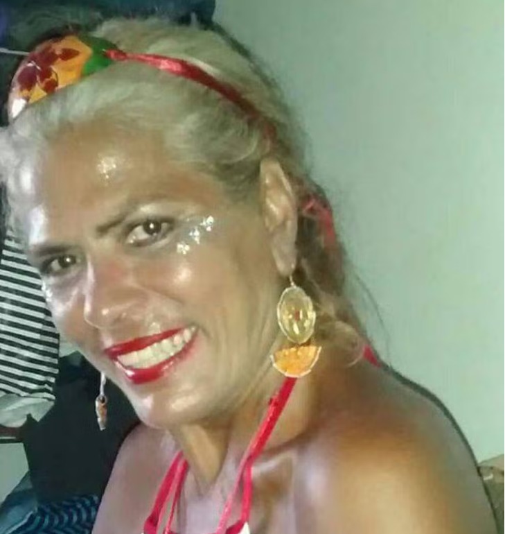 Ex-chacrete morre após ser atacada por pitbull do filho