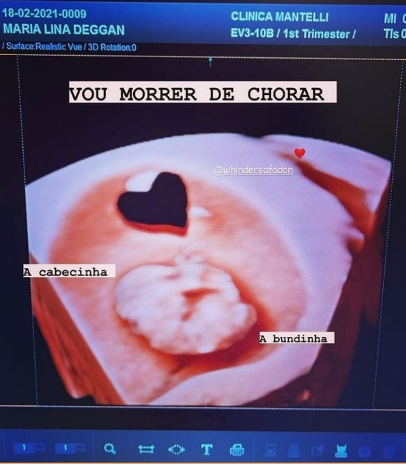 Maria mostra novo ultrassom do filho com Whindersson: ‘morrer de chorar'