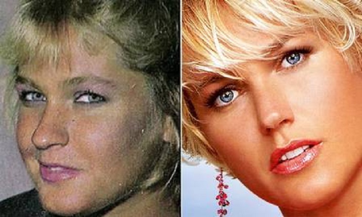 Xuxa revela que cirurgião plástico que operou seu nariz está preso