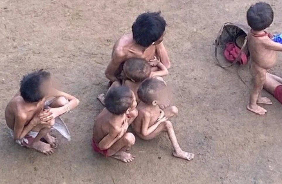 Deputado venezuelano diz que yanomamis desnutridos vieram de seu país para o Brasil