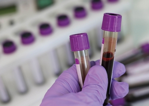 Amazonas registra 81 novos casos de Covid em apenas 1 dia