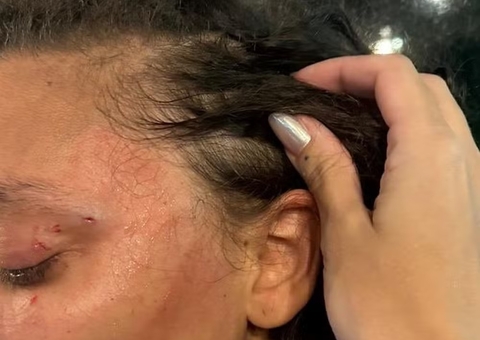 Mulher é agredida ao ser confundida com trans em banheiro de restaurante