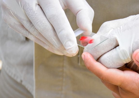 Nova medicação no tratamento de malária será implementada em Manaus