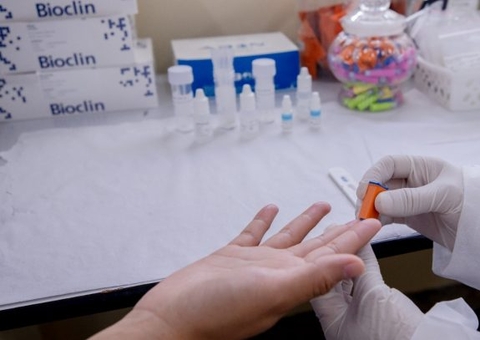 Julho amarelo: Unidades de Saúde preparam ações de prevenção às hepatites virais em Manaus