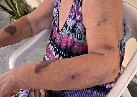 Idosa de 87 anos é espancada com cabo de vassoura pela neta em Manaus