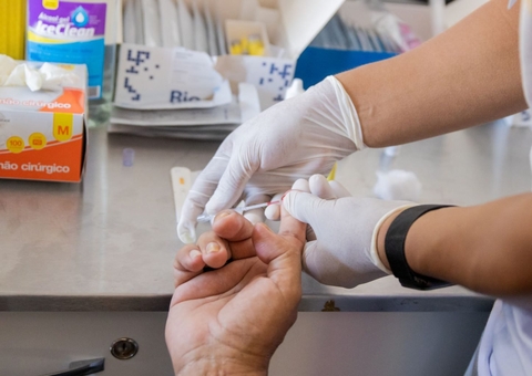 UBSs passam a oferecer PEP após registro de 165 novos casos de HIV em Manaus