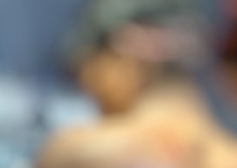 Homem tem cabeça rasgada após sofrer ataque de onça