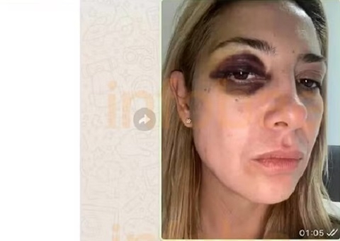 Ex-primeira-dama da Argentina diz que Fernández a pressionou a abortar